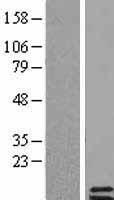 Tuberoinfundibular peptide (PTH2) Human Over-expression Lysates NM_178449
