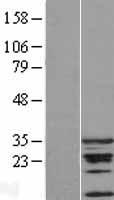 CDCA5 Human Over-expression Lysates NM_080668