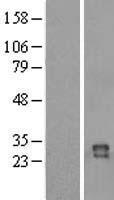 IZUMO4 Human Over-expression Lysates NM_001031735