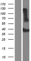 ADAT3 Human Over-expression Lysates NM_138422