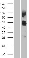 HCP1 (SLC46A1) Human Over-expression Lysates NM_080669