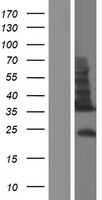 TMEM54 Human Over-expression Lysates NM_033504