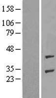 ls113622 adprhl1 human over expression lysates nm 199162 wb testing 1