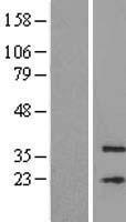 ls113655 mfsd3 human over expression lysates nm 138431 wb testing 1
