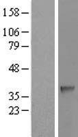 SDSL Human Over-expression Lysates NM_138432