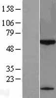 KLHDC7B Human Over-expression Lysates NM_138433