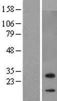 ls113763 c7orf29 zbed6cl human over expression lysates nm 138434 wb testing 1