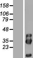 PIK3IP1 Human Over-expression Lysates NM_052880