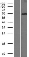 DTX2 Human Over-expression Lysates NM_001102595