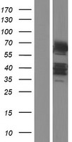 DTX2 Human Over-expression Lysates NM_001102596