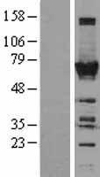 ls114034 toe1 human over expression lysates nm 025077 wb testing 1