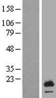 Urocortin 3 (UCN3) Human Over-expression Lysates NM_053049
