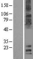 MAL2 Human Over-expression Lysates NM_052886