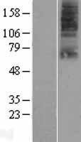 SLC22A9 Human Over-expression Lysates NM_080866