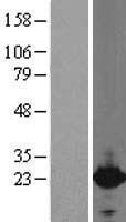 Cytoglobin (CYGB) Human Over-expression Lysates NM_134268