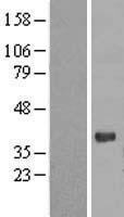 PGRP1A (PGLYRP3) Human Over-expression Lysates NM_052891