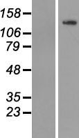 TUBGCP5 Human Over-expression Lysates NM_052903