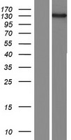 FMNL2 Human Over-expression Lysates NM_052905