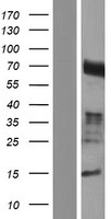 CCDC85A Human Over-expression Lysates NM_001080433