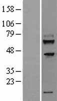 TMEM200A Human Over-expression Lysates NM_052913