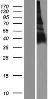 LY108 (SLAMF6) Human Over-expression Lysates NM_001184715