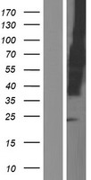 LY108 (SLAMF6) Human Over-expression Lysates NM_001184716