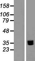 LY108 (SLAMF6) Human Over-expression Lysates NM_052931