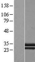 CTRP1 (C1QTNF1) Human Over-expression Lysates NM_198594