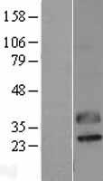CTRP2 (C1QTNF2) Human Over-expression Lysates NM_031908