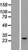 CTRP3 (C1QTNF3) Human Over-expression Lysates NM_030945