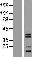 CTRP3 (C1QTNF3) Human Over-expression Lysates NM_181435