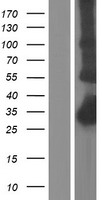 CTRP5 (C1QTNF5) Human Over-expression Lysates NM_015645