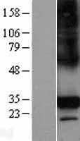 ls114904 ctrp6 c1qtnf6 human over expression lysates nm 031910 wb testing 1