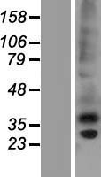 ls114904 ctrp6 c1qtnf6 human over expression lysates nm 182486 wb testing 2