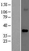 Fbx32 (FBXO32) Human Over-expression Lysates NM_058229