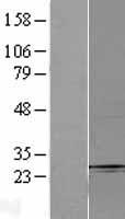 Fbx32 (FBXO32) Human Over-expression Lysates NM_148177