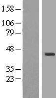 WDR31 Human Over-expression Lysates NM_145241