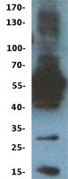 ls115004 c6orf150 mb21d1 human over expression lysates nm 138441 wb testing 1