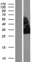 NT5C3L (NT5C3B) Human Over-expression Lysates NM_052935