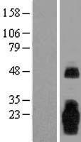 MARCHF3 Human Over-expression Lysates NM_178450