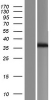 FBXO17 Human Over-expression Lysates NM_148169