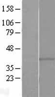 GPR146 Human Over-expression Lysates NM_138445