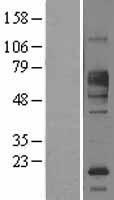 FCRL1 Human Over-expression Lysates NM_052938