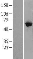 GBP5 Human Over-expression Lysates NM_001134486