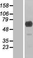GEFT (ARHGEF25) Human Over-expression Lysates NM_182947