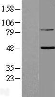 ls115572 tent5b human over expression lysates nm 052943 wb testing 1