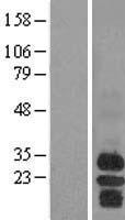 BAFF Receptor (TNFRSF13C) Human Over-expression Lysates NM_052945