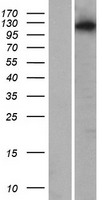 SNX26 (ARHGAP33) Human Over-expression Lysates NM_052948
