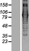 EVI5L Human Over-expression Lysates NM_145245