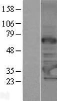 C14orf172 (TRMT61A) Human Over-expression Lysates NM_152307